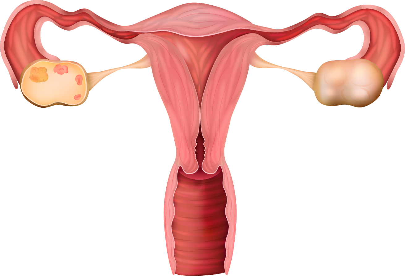 Troubles uro-gynécologiques - endométriose - Ostéopathe Le Plessis-Trévise - Marie-Alizée Lilly