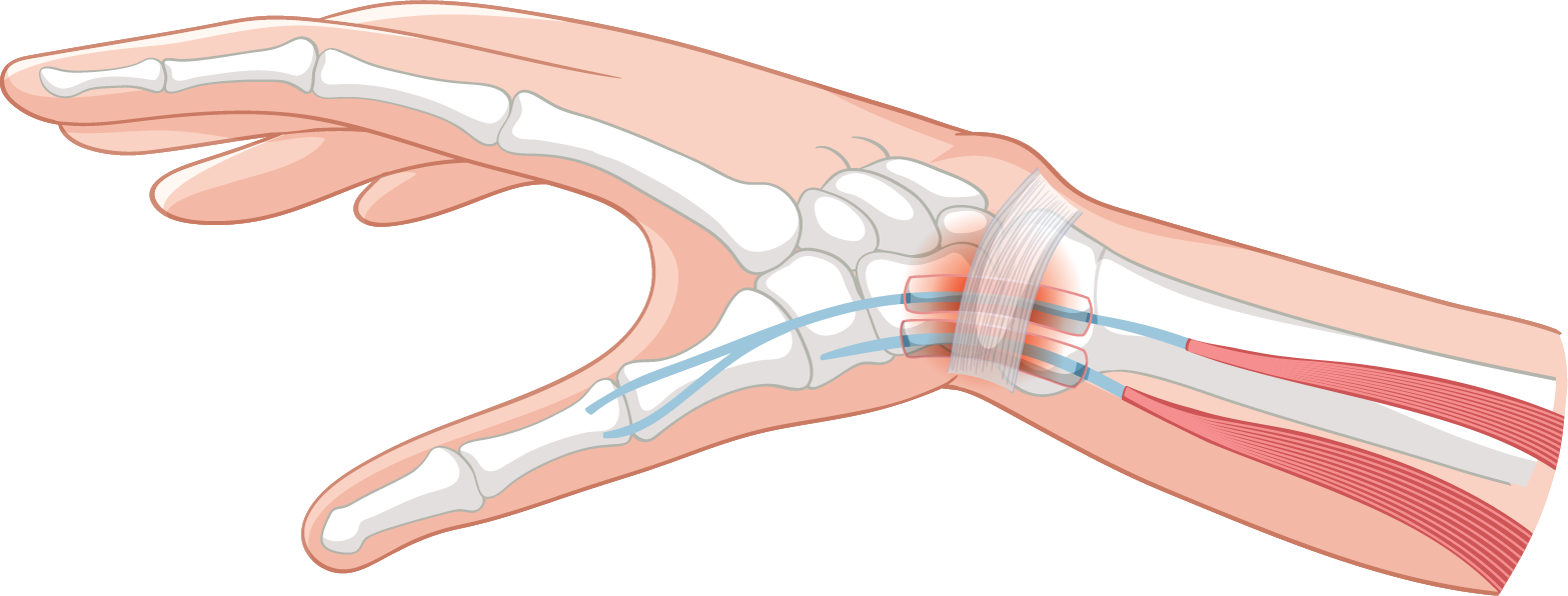 Main - Hanche, genou - Troubles musculosquelettiques - Ostéopathe Le Plessis-Trévise - Marie-Alizée Lilly